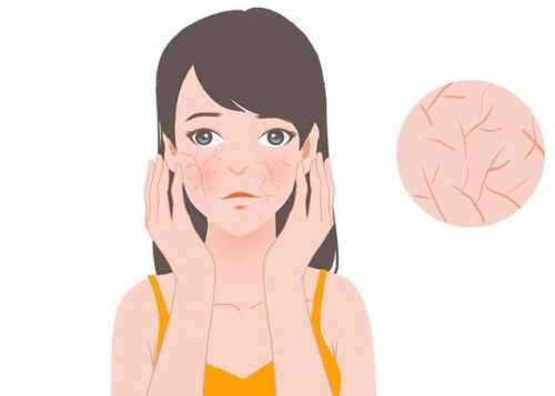霜：修护敏感肌肤重塑健康屏障J9国际集团第二代薇诺娜特护(图3)